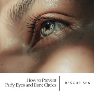How to Prevent Puffy Eyes and Dark Circles